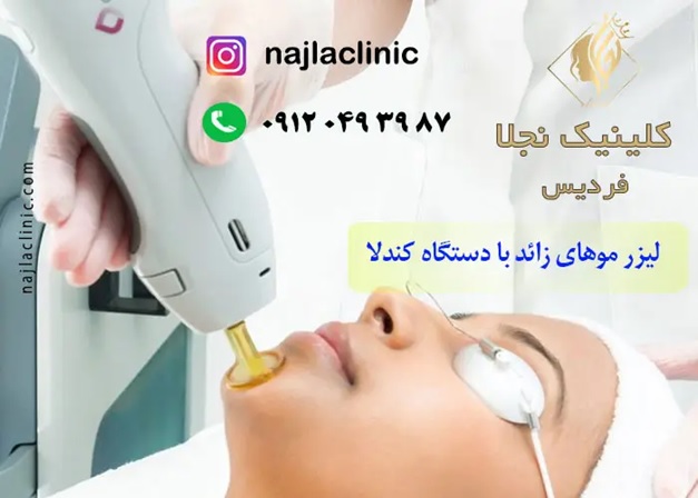 بهترین کلینیک لیزر در فردیس